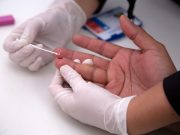 Komisi D DPRD Kota Semarang Minta Penyedia Layanan Rapid Test Segera Sesuaikan Tarif