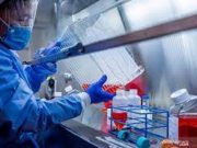 CDC AS: Uji Corona Tak Perlu bagi yang Terpapar Tanpa Gejala