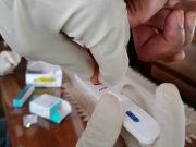 Kabupaten Tegal Butuh Puluhan Ribu Alat Rapid Test