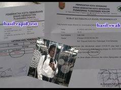Hasil Rapid Test Reaktif? Bahagia Saja Keles