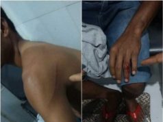 Perihal Tak Beri Uang Parkir, Juru Parkir Nekat Tusuk Pengunjung