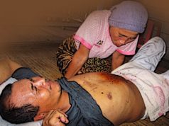 Bakatmu: Tutur, Wuwur, Apa Sembur?