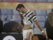Fernandes Tak Terima Dikritik