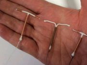 Intra Uterine Device Salah Satu Pilihan Terbaik Menunda Kehamilan Saat Pandemi Covid-19
