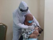Sambut Hari Jadi Dokkes, RS Bhayangkara Awaloedin Djamin Gelar Operasi Bibir Sumbing