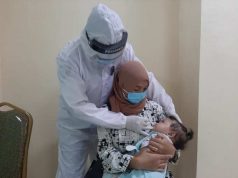 Sambut Hari Jadi Dokkes, RS Bhayangkara Awaloedin Djamin Gelar Operasi Bibir Sumbing