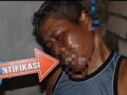Penarik Becak Asal Jepara Bunuh Diri di Tuban, Adakah yang Mengenal Korban?