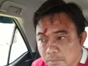 LPSK Dorong Aparat Ungkap Motif Pengeroyokan Ketua KNPI