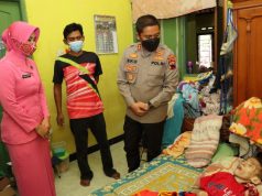 Bocah Mengidap Penyumbatan Selaput Otak Terima Bantuan Kapolres Klaten