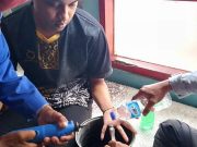 Jari Tangan Anak Jangan Dipasangi Cincin, Ini yang Menjadi Alasannya