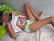 Bocah Penderita Megakolon di Tegal Butuh Uluran Tangan