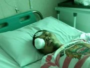 Solekan Penderita Tumor Mata Kini Dirawat di RSUD RA Kartini, Keluarga: Matur Nuwun Pak Pj Bupati