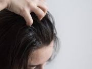 Tips Menghilangkan Gatal Pada Rambut Karena Ketombe