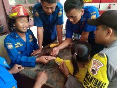Damkar Grobogan Bantu Melepas Cincin dari Jari Anak yang Bengkak