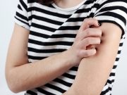 Gatal karena Alergi? Simak Penjelasan Ini!