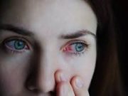 Tips Agar Mata Merah Bisa Segera Kembali Putih Normal
