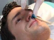Tips Bersihkan Bulu Hidung