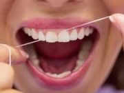 Tips Bersihkan Karang Gigi