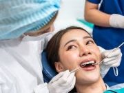 Tips Bersihkan Karang Gigi