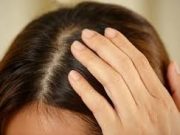 Tips Membersihkan Kulit Kepala Dari Kotoran Rambut