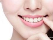 Tips Membuat Gigi Putih Alami