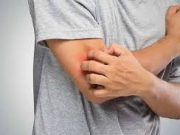 Tips Menghilangkan Gatal Kulit Akibat Iritasi