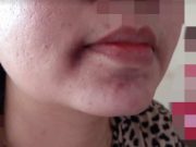 Larang Suami Bermain Judi Online, Istri Dianiaya
