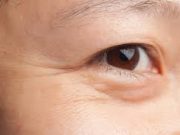 Tips Menghilangkan Kerutan di Wajah