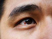 Ini Penyebab Pembuluh Darah Mata Pecah, Apa Saja? Simak!