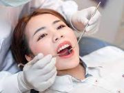 Tips Membersihkan Karang Gigi