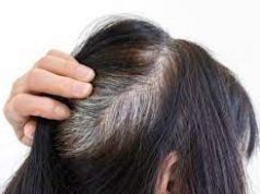 Tips Menutupi Uban Pada Rambut Kepala