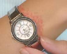 Tips Memakai Jam Tangan, Agar Kulit Tidak Iritasi