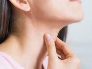 Tips Mengurangii Rasa Gatal pada Tenggorokan