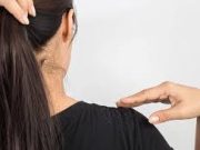 Tips Merontokkan Ketombe Secara Ampuh dan Alami