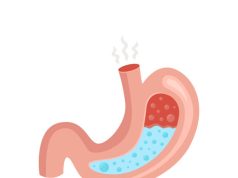 Ini Perbedaan Asam Lambung dan Maag, Kamu Wajib Tahu!