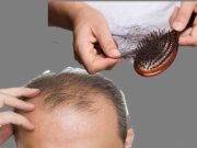 Rambut Anda Rontok, Ini Bahan Alami untuk Mengatasinya