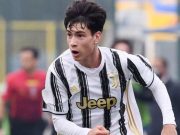Calon Bintang Masa Depan Bianconeri