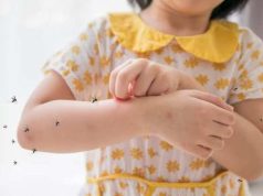 Membuat Kurang Percaya Diri, 7 Tips Menghilangkan Bekas Gigitan Nyamuk yang Mudah Dilakukan