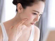 Tips Menghilangkan Bekas Jerawat