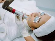 Perlukah Laser untuk Menghilangkan Flek Hitam di Wajah?
