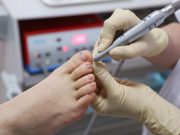 Begini Tips Merawat Kuku Kaki agar Tetap Sehat dan Bersih!