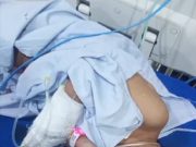 Bocah Korban Pencabulan di Jepara Dirawat Intensif di RS Rehatta Kelet, Beredar Video Kesakitan