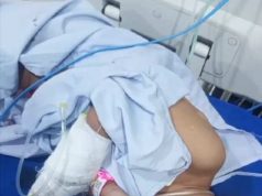 Bocah Korban Pencabulan di Jepara Dirawat Intensif di RS Rehatta Kelet, Beredar Video Kesakitan