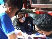 Waduh, Komponen Kick Starter Motor ‘Manjing’ di Jari Tangan