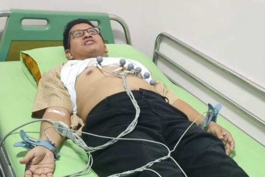 Seluruh Anggota DPRD Kota Tegal Jalani Pemeriksaan Kesehatan Berkala